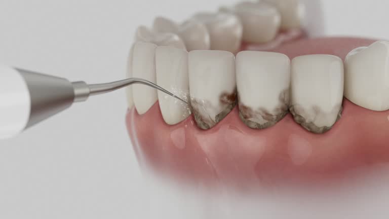 Reliable Dental Implants contractor in Parrish, AL by Smile Center Dentistry